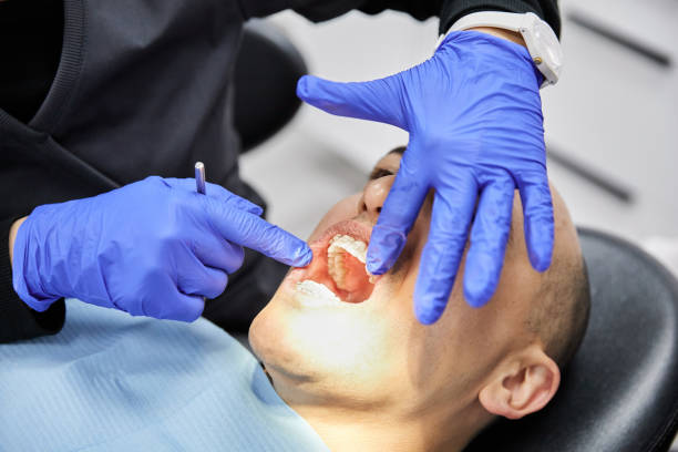 Best Emergency Cosmetic Dentistry (e.g., broken veneers) in Elk Mound, WI